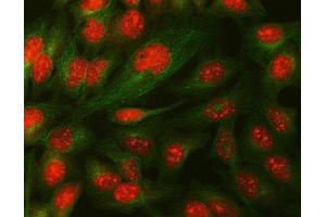 IF analysis of Daxx using anti-Daxx antibody (ABIN3043822) and anti-Tubulin Alpha antibody (ABIN7600339). (DAXX antibody  (AA 56-345))