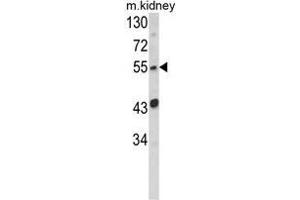 Western blot analysis of SIL1 Antibody (Center) in mouse kidney tissue lysates (35ug/lane). (SIL1 antibody  (Middle Region))