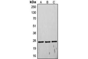 Western blot analysis of TIMP4 expression in Sol8 (A), MCF7 (B), HeLa (C) whole cell lysates. (TIMP4 antibody  (C-Term))
