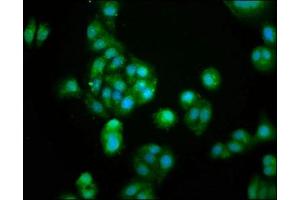 Immunofluorescence staining of HepG2 cells with ABIN7154765 at 1:100, counter-stained with DAPI. (GUCA2B antibody  (AA 37-112))