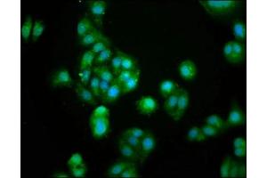 Immunofluorescence staining of HepG2 cells with ABIN7154765 at 1:100, counter-stained with DAPI. (GUCA2B antibody  (AA 37-112))