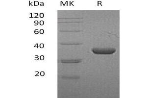 Lactate Dehydrogenase A Protein (LDHA) (His tag)