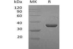 Western Blotting (WB) image for Lactate Dehydrogenase A (LDHA) protein (His tag) (ABIN7320609) (Lactate Dehydrogenase A Protein (LDHA) (His tag))