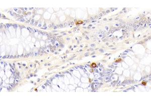 Immunohistochemistry (IHC) image for anti-Tumor Necrosis Factor Receptor Superfamily, Member 10b (TNFRSF10B) (AA 234-435) antibody (ABIN7442663)
