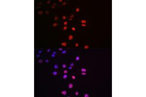 Immunofluorescence (IF) image for anti-Ribosomal Protein S6 Kinase, 70kDa, Polypeptide 1 (RPS6KB1) (pSer424), (pThr421) antibody (ABIN6136296)