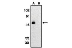 Image no. 1 for anti-Chemokine (C-X3-C Motif) Receptor 1 (CX3CR1) (AA 175-189) antibody (ABIN265002) (CX3CR1 antibody  (AA 175-189))