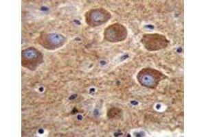 PAK6 antibody immunohistochemistry analysis in formalin fixed and paraffin embedded human brain tissue. (PAK6 antibody  (AA 268-297))