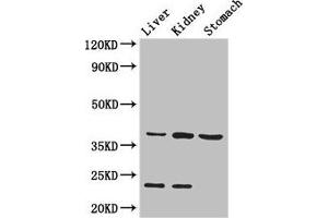 Western Blot Positive WB detected in: Mouse liver tissue, Mouse kidney tissue, Mouse stomach tissue All lanes: Akr1a1 antibody at 2. (AKR1A1 antibody  (AA 2-325))