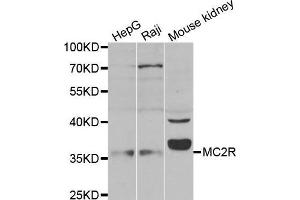 Western blot analysis of extracts of 293 cell lysate, using MC2R antibody. (MC2R antibody)