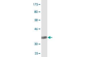 Western Blot detection against Immunogen (37. (SIAH1 antibody  (AA 1-110))