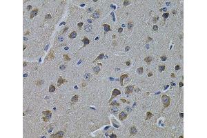Immunohistochemistry of paraffin-embedded Rat brain using ERBB3 Polyclonal Antibody at dilution of 1:100 (40x lens). (ERBB3 antibody)