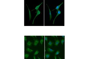 ICC/IF analysis of CSTB in U87MG cells line, stained with DAPI (Blue) for nucleus staining and monoclonal anti-human CSTB antibody (1:100) with goat anti-mouse IgG-Alexa fluor 488 conjugate (Green). (CSTB antibody  (AA 1-98))