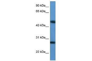 Western Blot showing TM2D2 antibody used at a concentration of 1-2 ug/ml to detect its target protein. (TM2D2 antibody  (Middle Region))
