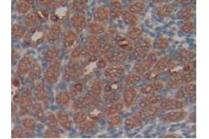 IHC-P analysis of Rat Kidney Tissue, with DAB staining. (Hexokinase 1 antibody  (AA 413-540))