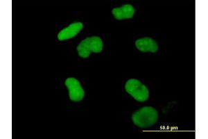 Immunofluorescence of purified MaxPab antibody to ZNF502 on HeLa cell.