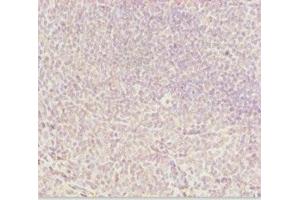 Immunohistochemistry of paraffin-embedded human tonsil tissue using ABIN7144962 at dilution of 1:100 (DDX11 antibody  (AA 1-220))