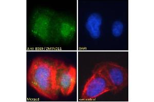ABIN184908 Immunofluorescence analysis of paraformaldehyde fixed U2OS cells, permeabilized with 0. (ZMYND11 antibody  (N-Term))