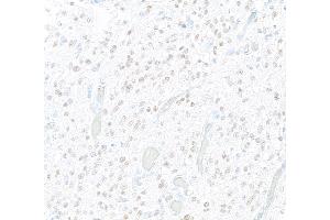 Immunohistochemistry (IHC) image for anti-SRY (Sex Determining Region Y)-Box 2 (SOX2) antibody (ABIN7449421) (SOX2 antibody)