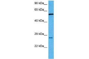 Host:  Mouse  Target Name:  RBPJ  Sample Tissue:  Mouse Liver  Antibody Dilution:  1ug/ml (RBPJ antibody  (C-Term))