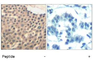 Image no. 1 for anti-HDAC4,HDAC5,HDAC9 (Ser220), (Ser246), (Ser259) antibody (ABIN319390) (HDAC4/HDAC5/HDAC9 antibody  (Ser220, Ser246, Ser259))