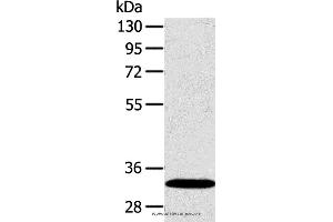 Western blot analysis of Human fetal liver tissue, using SULT2A1 Polyclonal Antibody at dilution of 1:650 (SULT2A1 antibody)