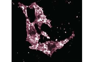 Immunofluorescent staining of HeLa cells with anti-Ezrin antibody.