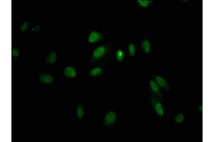 Immunofluorescence staining of Hela cells with ABIN7158383 at 1:100, counter-stained with DAPI. (LHX2 antibody  (AA 197-377))