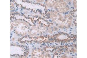 #VALUE! (GAA antibody  (AA 70-225))