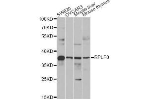 Western blot analysis of extracts of various cell lines, using RPLP0 antibody (ABIN6290910) at 1:1000 dilution.