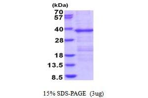 Homocysteine-Inducible, Endoplasmic Reticulum Stress-Inducible, Ubiquitin-Like Domain Member 1 (HERPUD1) (AA 1-263) protein (His tag)