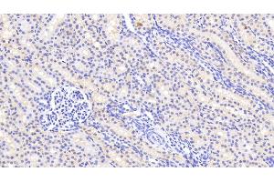 Detection of AGMAT in Human Kidney Tissue using Polyclonal Antibody to Agmatine Ureohydrolase (AGMAT) (AGMAT antibody  (AA 53-151))