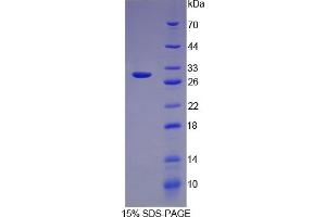 SDS-PAGE of Protein Standard from the Kit (Highly purified E. (Transferrin ELISA Kit)