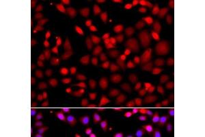 Immunofluorescence analysis of A549 cells using MTUS1 Polyclonal Antibody (MTUS1 antibody)