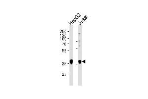 Western blot analysis of lysates from HepG2,Jurkat cell line (from left to right),using MTR1B Antibody (ABIN486400 and ABIN1535781).