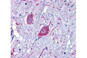 Anti-GPR6 antibody  ABIN1048845 IHC staining of human brain, neurons and glia. (GPR6 antibody  (C-Term))