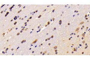 Detection of RGS6 in Rat Cerebrum Tissue using Polyclonal Antibody to Regulator Of G Protein Signaling 6 (RGS6) (RGS6 antibody  (AA 1-472))