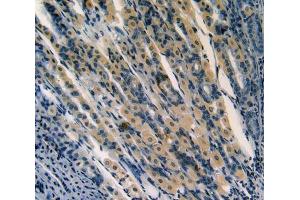 Used in DAB staining on fromalin fixed paraffin- embedded stomach tissue (aHSP antibody  (AA 2-102))