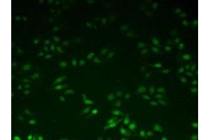 Detection of UBE2I in Human Hela Cells using Polyclonal Antibody to Ubiquitin Conjugating Enzyme E2I (UBE2I) (UBE2I antibody  (AA 33-158))