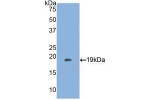 Detection of Recombinant HSPb3, Human using Polyclonal Antibody to Heat Shock Protein Beta 3 (HSPb3) (HSPB3 antibody  (AA 1-150))
