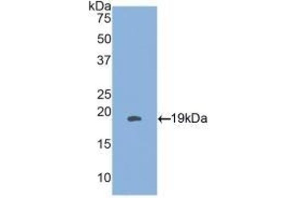 HSPB3 Antikörper  (AA 1-150)
