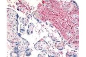 Immunohistochemistry (IHC) image for anti-Dipeptidyl-Peptidase 4 (DPP4) (N-Term) antibody (ABIN2469484)