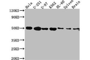 Western Blot Positive WB detected in: Hela whole cell lysate, U-251 whole cell lysate, U-87 whole cell lysate, K562 whole cell lysate, HL-60 whole cell lysate, Rat Spleen whole cell lysate, Rat Brain whole cell lysate All lanes: Dopamine Receptor D3 antibody at 1:1000 Secondary Goat polyclonal to rabbit IgG at 1/50000 dilution Predicted band size: 45, 41 kDa Observed band size: 50 kDa (Recombinant DRD3 antibody)