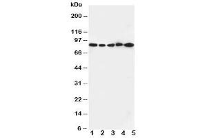 Western blot testing of CD18 antibody and Lane 1:  Jurkat cell lysate (Integrin beta 2 antibody  (C-Term))
