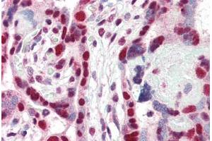 Human Placenta (formalin-fixed, paraffin-embedded) stained with CBX3 antibody ABIN337123 at 2. (CBX3 antibody  (AA 74-87))