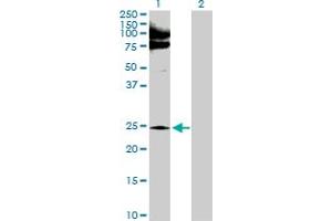Western Blot analysis of NQO2 expression in transfected 293T cell line by NQO2 MaxPab polyclonal antibody. (NQO2 antibody  (AA 1-231))