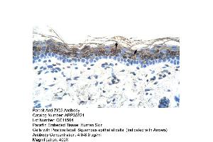 Human Skin (ZIC2 antibody  (C-Term))