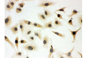 Immunohistochemistry (IHC) image for anti-SHC (Src Homology 2 Domain Containing) Transforming Protein 1 (SHC1) (AA 424-440), (C-Term) antibody (ABIN3044111)