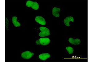 Immunofluorescence of monoclonal antibody to TRIM28 on HeLa cell. (KAP1 antibody  (AA 379-524))