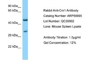 Western Blotting (WB) image for anti-Cannabinoid Receptor 1 (CNR1) (C-Term) antibody (ABIN970424) (CNR1 antibody  (C-Term))