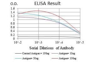 Black line: Control Antigen (100 ng), Purple line: Antigen(10 ng), Blue line: Antigen (50 ng), Red line: Antigen (100 ng), (KCNQ1 antibody)